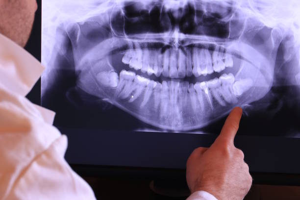 Best Mobile Emergency Dentist in Kitsap Lake, WA