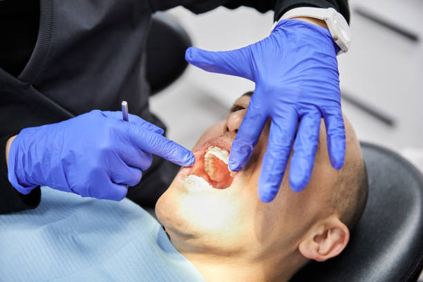 Best Emergency Dentist for Lost Fillings or Crowns in Kitsap Lake, WA